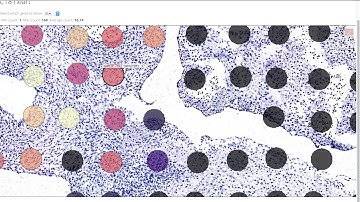 ST C18heart web demo