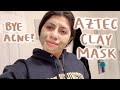 trying the aztec clay mask for 2 weeks