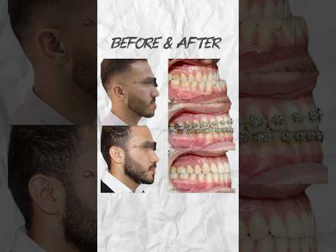 درمان ارتودنسی دکتر سعید قریشی دندانپزشکی متخصص ارتودنسی Dentist 