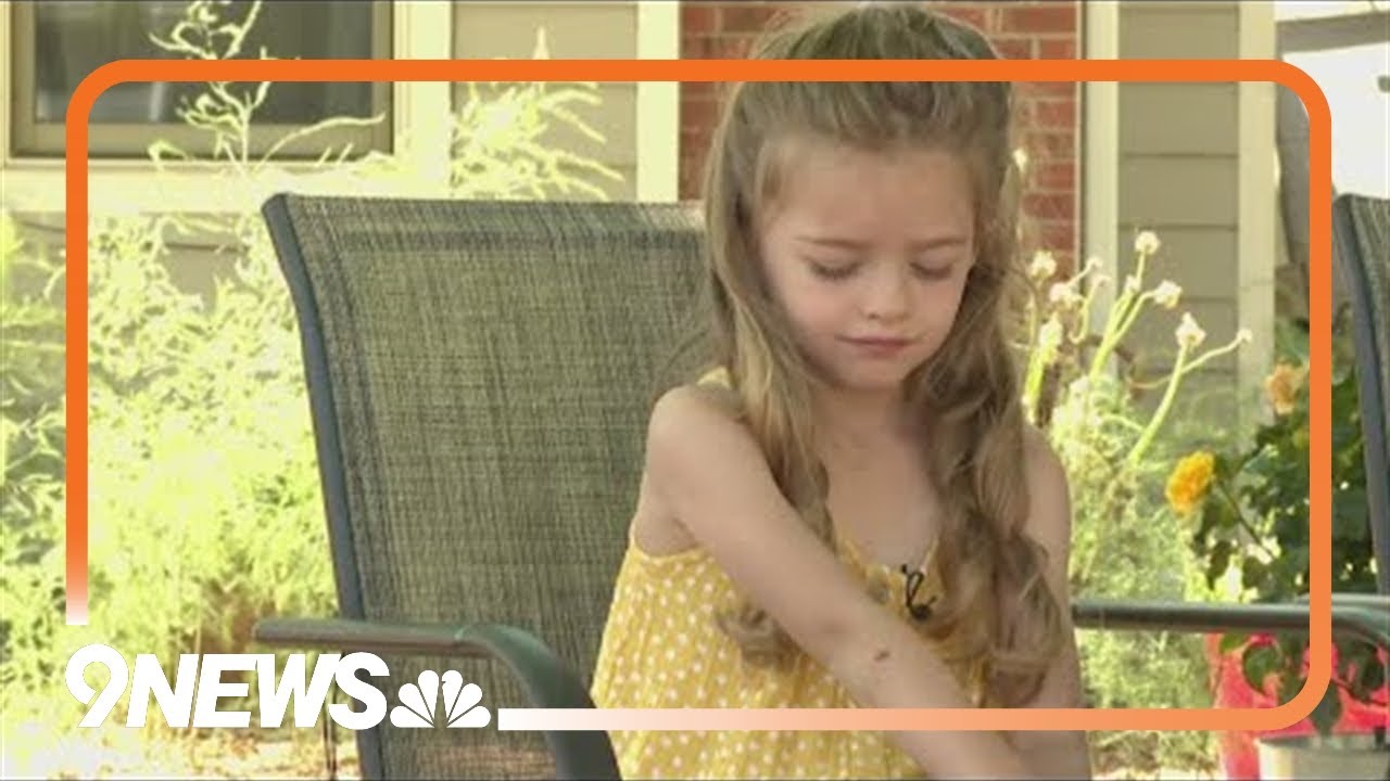 6-year-old girl recovering after dog attack in Fort Collins - YouTube