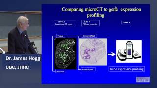 Dr  Hogg COPD 2013