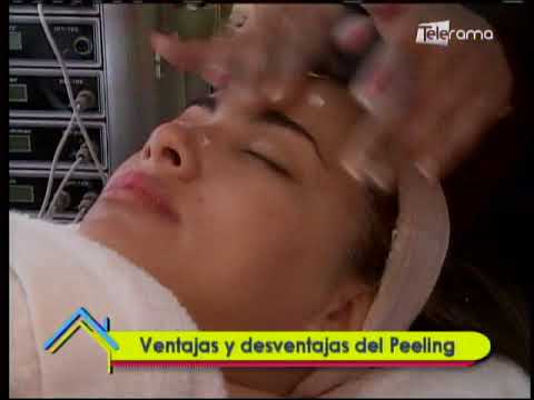 Ventajas y desventajas del Peeling