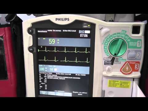 Philips ECG Management Systems - Telemedicine in the Baleares
