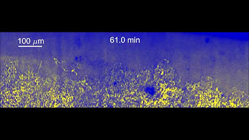Operando X-ray image on Li dendrite growth