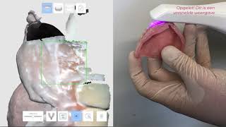 Evo Twin- Prothese Scan