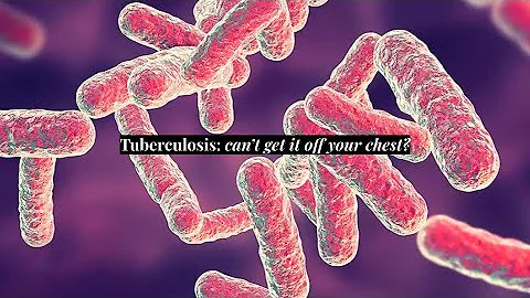 Tuberculosis part 2: Can’t get it off your chest?