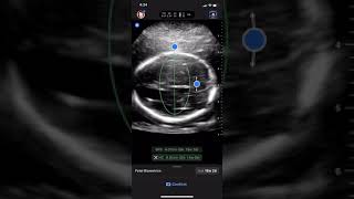 OB Calcs 1 | Clinical Image