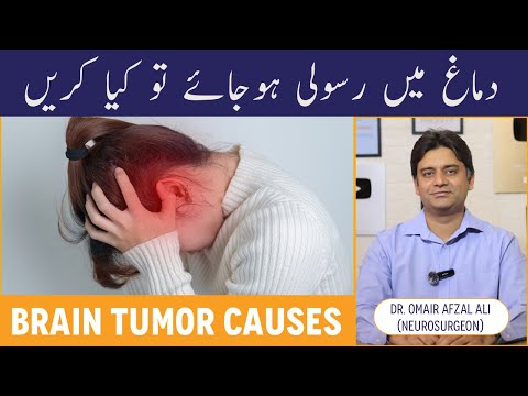 Dimagh Ki Rasoli Ka Ilaj - Brain Tumor Causes & Treatment - Dimagh Me Rasoli Hojaye To Kya Karen