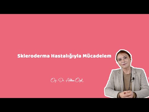 Video: Skleroderma sizə harada təsir edir?