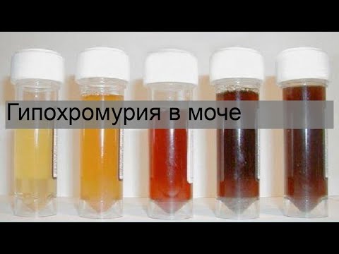 Гипохромурия в моче