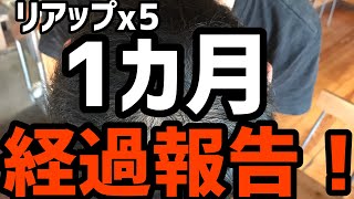 リアップx5 使い始めて一カ月の報告。