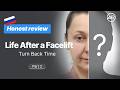 Part2. Deep Plane Facelift 4-Month Real Interview ✨ AB Plastic Surgery Korea