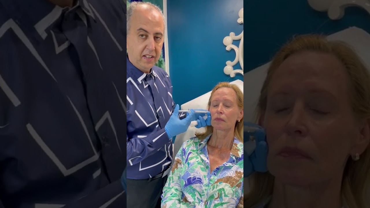 Radiesse Cheek Filler Injection: Instant Lift & Collagen Boost! | Dr. Dahabra #shorts