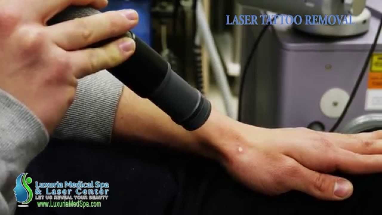 laser tattoo removal www luxuriamedspa com egg harbor township nj laser tattoo removal www luxuriamedspa com egg harbor township nj