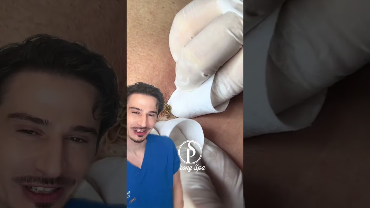 Let me aCYST with this… #dermreacts  #skincare  #dermatologist #dermangelo  #reactionvideo