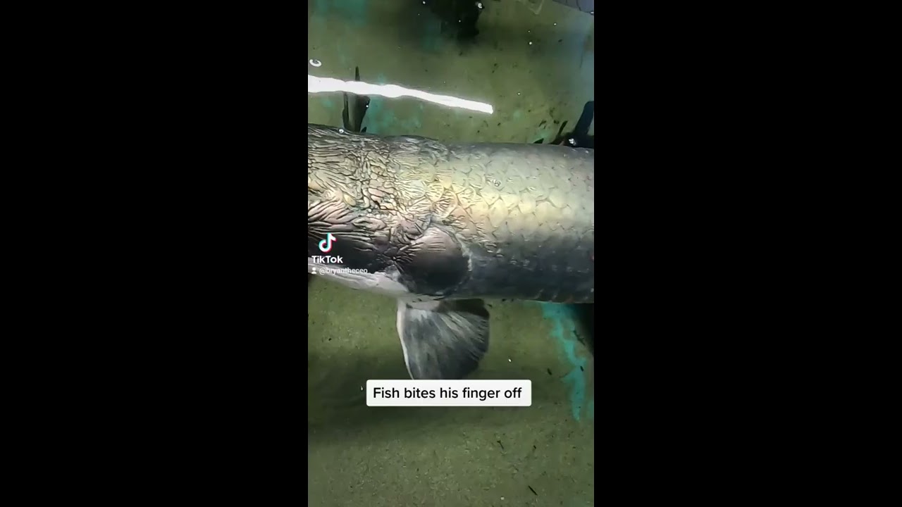 Fish Bites His Finger Off