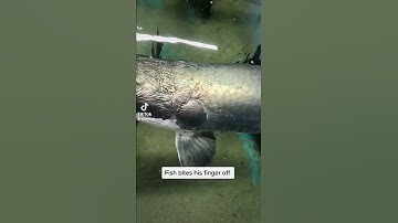 Fish Bites His Finger Off