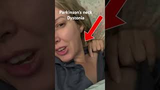 Parkinsons Neck Dystonia