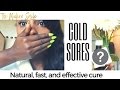 How to Heal and Cure a Cold Sore Overnight....Fast, Natural, and It Works!!