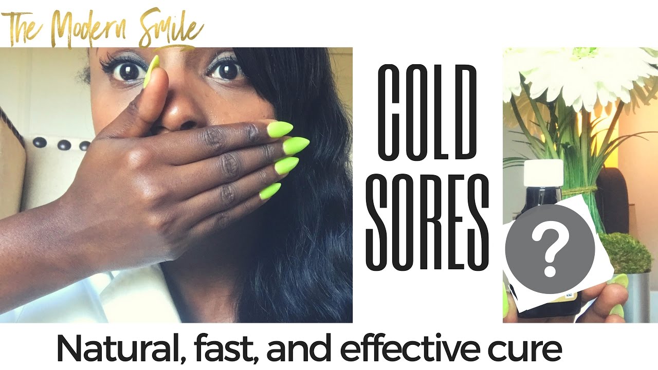 How to Heal and Cure a Cold Sore Overnight....Fast