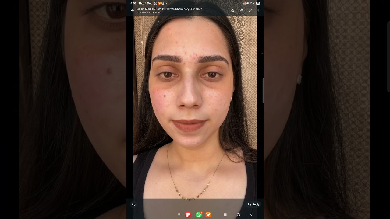 Skin care customised package feedback my customer Ishika