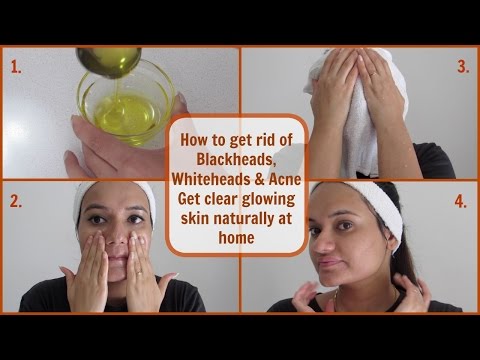 Get rid of Blackheads, Whiteheads & Acne | Oil Cleansing Method