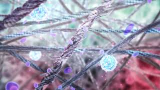 Human cartilage inflammation - 3D video