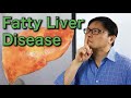 How to reverse fatty liver disease naturally  jason fung