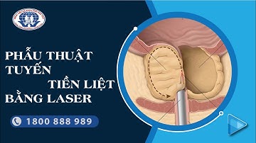 Phẫu thuật tuyến tiền liệt bằng laser