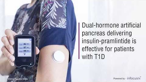 Insulin-Pramlintide Dual-Hormone Artificial Pancreas Shows Efficacy in T1D Patients.