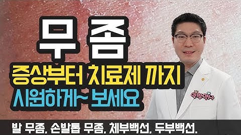 [무좀] 무좀치료, 무좀발톱 약사설명 증상부터 무좀약까지 - 카네스텐, 라미실, 티어실, 풀케어, 주블리아 등