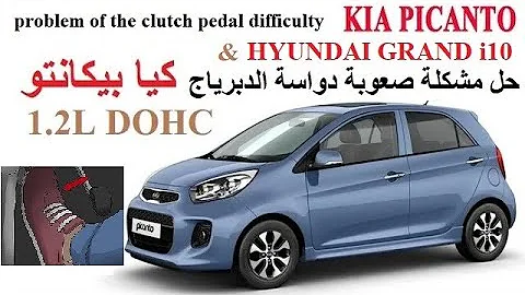 Problème boîte de vitesse sur Kia Picanto ?