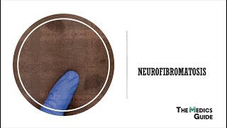 Neurofibromatosis Type 1 and 2 - A Clinical Overview for Medical Students