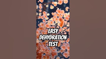 Are You Actually Hydrated? Take the Skin Turgor Test