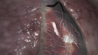 Oral health & general health - trailer
