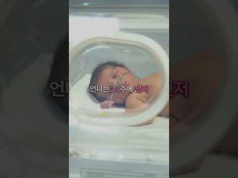 87일 차이로 태어난 아일랜드 쌍둥이 자매