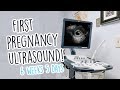FIRST PREGNANCY ULTRASOUND! - 6 Weeks Pregnant & No Heartbeat Yet