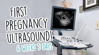 First Pregnancy Ultrasound - 6 Weeks Pregnant & No Heartbeat Yet