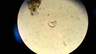 Pond Parasite2 - 170511