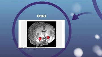 Canli et al. experiment Part 1 (Cambridge International AS Level psychology) 9990