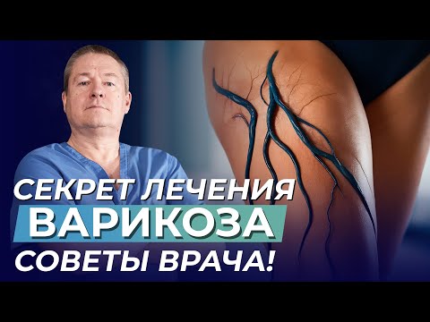 Лечение варикоза ног без операции | Советует доктор Божьев