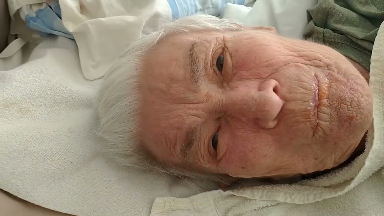 Feeding semisoft food to supine person (bedridden)