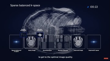 Philips Compressed SENSE - how does it work?