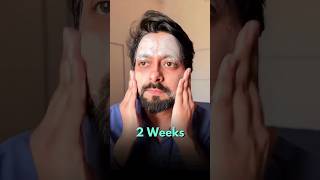 Get Acne Free Skin In 1 week - Derma co SalicylicAcid Face Wash#shortsfeed#dermaco