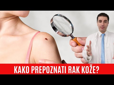 Video: ❶ Ako Skryť Nedokonalosti Kože