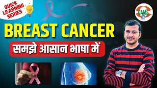 Breast Cancer Detailed Explanation Quick Learning Series By Siddharth Sir Dams Nursing