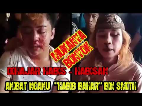 sangar-..!!-muka-jadi-bonyok-||-akibat-ngaku-"habib-bahar"-bin-smith