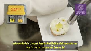 การใช้ระบบยึดติดแบบ 2-step self-etch ร่วมกับการทำ selective enamel etching