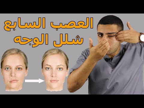 شلل الوجه النصفى أهم التمارين والستريتشات والمساج لعلاج شلل الوجه العصب السابع