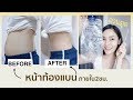 ♡ Howto I หน้าท้องแบนภายใน 2 ชม. ด้วยวิธีธรรมชาติ